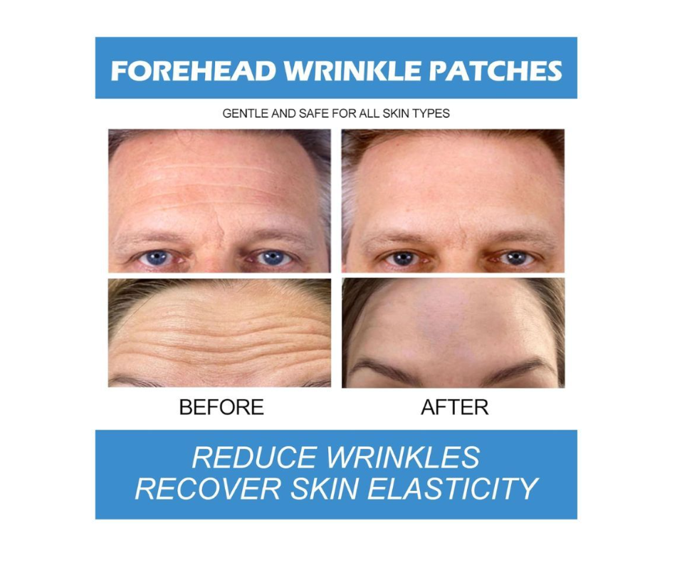 6-Pack Royal Prestige Anti-Wrinkle Forehead Patches with Microcrystalline Nicotinamide